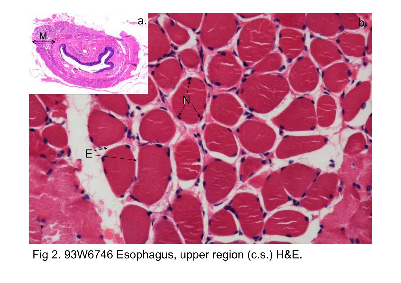 block6-2_07.jpg - Fig 2. 93W6746 Esophagus, upper region (c.s.) H&E.Fig 2a. The muscularis externa (M) of the upper portion of theesophagus belongs to the skeletal muscle, appearing the innercircular and outer longitudinal arrangement patterns.Fig 2b shows high-magnification of cross sectioned musclecells, appearing the polygonal profiles. Notice the numerous ofperipherally located multinuclei (N). Endomysium (E) is a layerof basal lamina, surrounding each individual muscle fibers.            Skeletal muscle