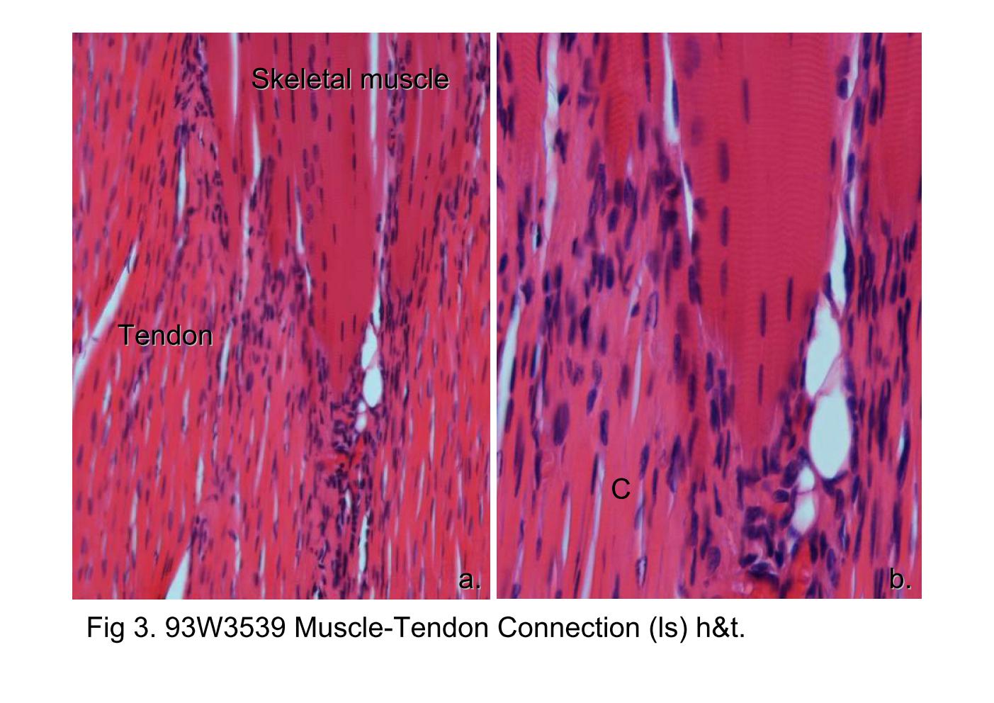 block6-2_09.jpg - Fig 3. 93W3539 Muscle-Tendon Connection (ls) h&t.Fig 3a shows the junction of the skeletal muscle fibers andtendon. Notice the striation characteristics of skeletal muscleand the abundances of collagens fibers (C) in the tendon.Fig 3b shows the high-magnification of 3a. Examined thediscrepancy of nucleus location between skeletal musclesand tendon tissues: peripherally location in skeletal muscle vs.dispersed within collagen fibres in the tendon.