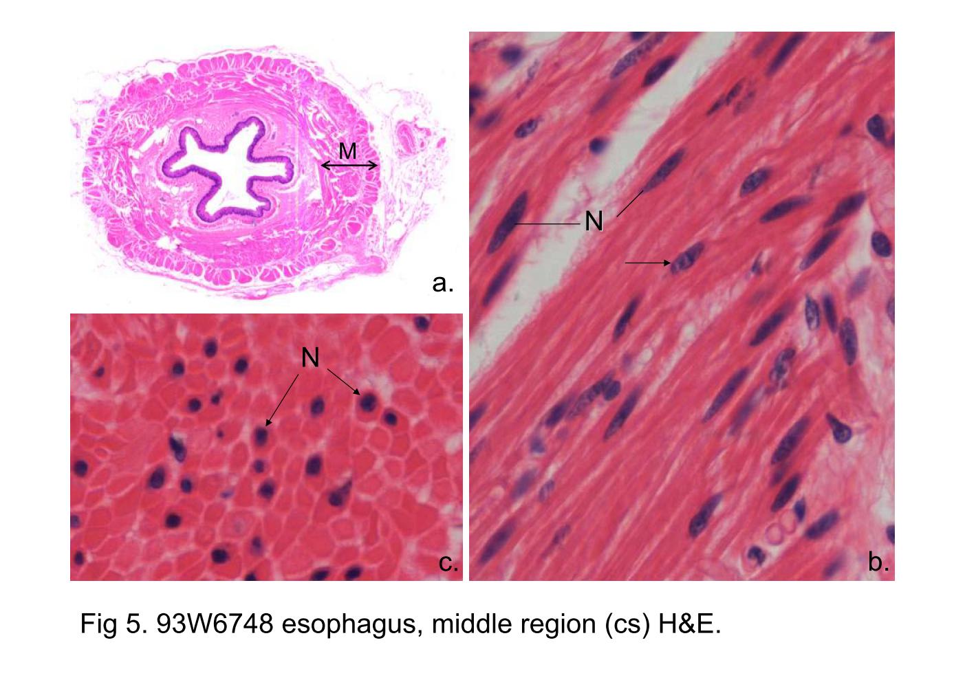 block6-2_13.jpg - Fig 5. 93W6748 esophagus, middle region (cs) H&E.Fig 5a. The muscularis externa (M) of the middle portion of theesophagus is composed of smooth muscle and skeletal muscle.The muscle fibers are arranged into two layers (inner circular &outer longitudinal).Smooth muscle cells is spindle-shaped in the longitudinalsection (Fig 5b). Their nuclei (N) are also elongated andconform to the general shape of the cell. A nuclei display slightlytwisted is indicated by an arrow, like a corkscrew; this ischaracteristic of contracted cells.Fig 5c shows a cross-sectioned of the smooth muscle cells,displaying circular or polygonal profiles with variations on size.In most of the cells, the nuclei (N) have not been included in thesection, and only the eosinophilic cytoplasm appears.