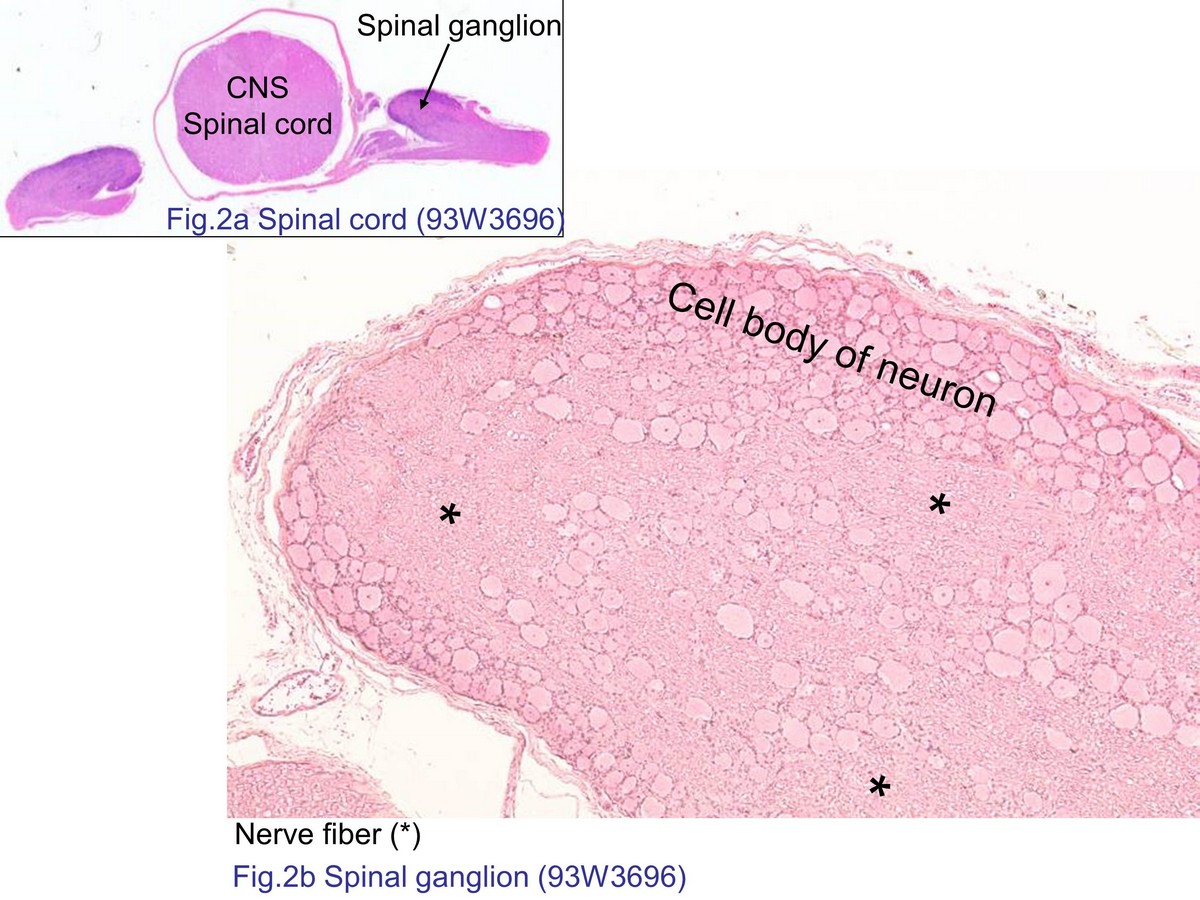 block7_07.jpg - Fig. 2 Micrograph of spinal ganglion. Spinal ganglia (alsocalled dorsal root ganglion) located next to the spinal cord.Spinal ganglion is the gathering of pseudounipolar sensoryneurons with central and peripheral processes thatterminated on dorsal horn of spinal cord and the periphery,respectively. Typical spinal ganglion section showsdifferent diameter of sensory neurons and mingles withnerve processes (asterisk) that originated from thosesensory neurons.