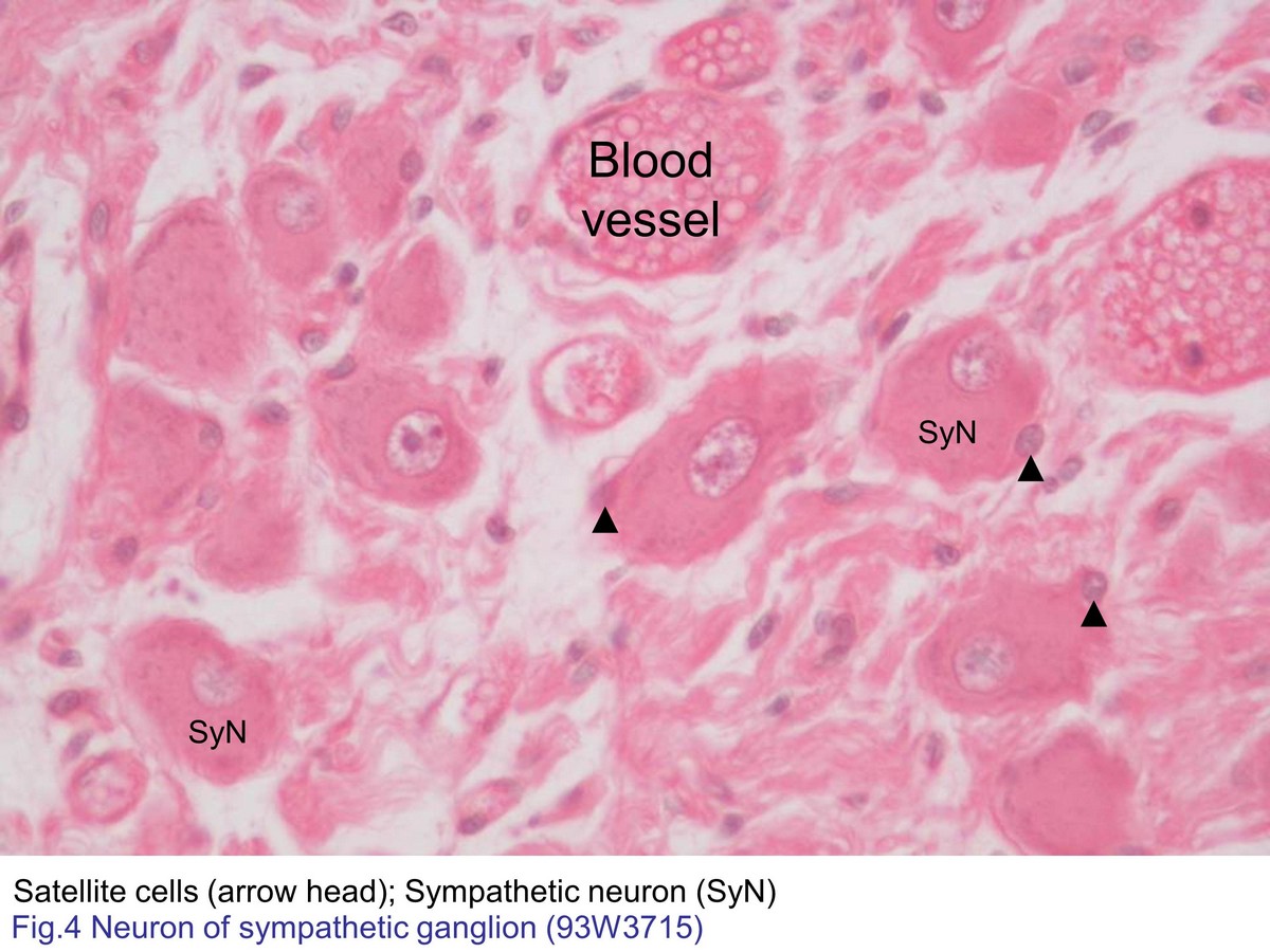 block7_11.jpg - Fig. 4 Micrograph of sympathetic ganglion. Sympatheticneurons (SyN) are multipolar neurons that surrounded withthe satellite cells (arrowhead). Notice there is fewer ofsatellite cells in the sympathetic ganglion that comparedwith those in the spinal ganglions. (Compare with Fig.3)