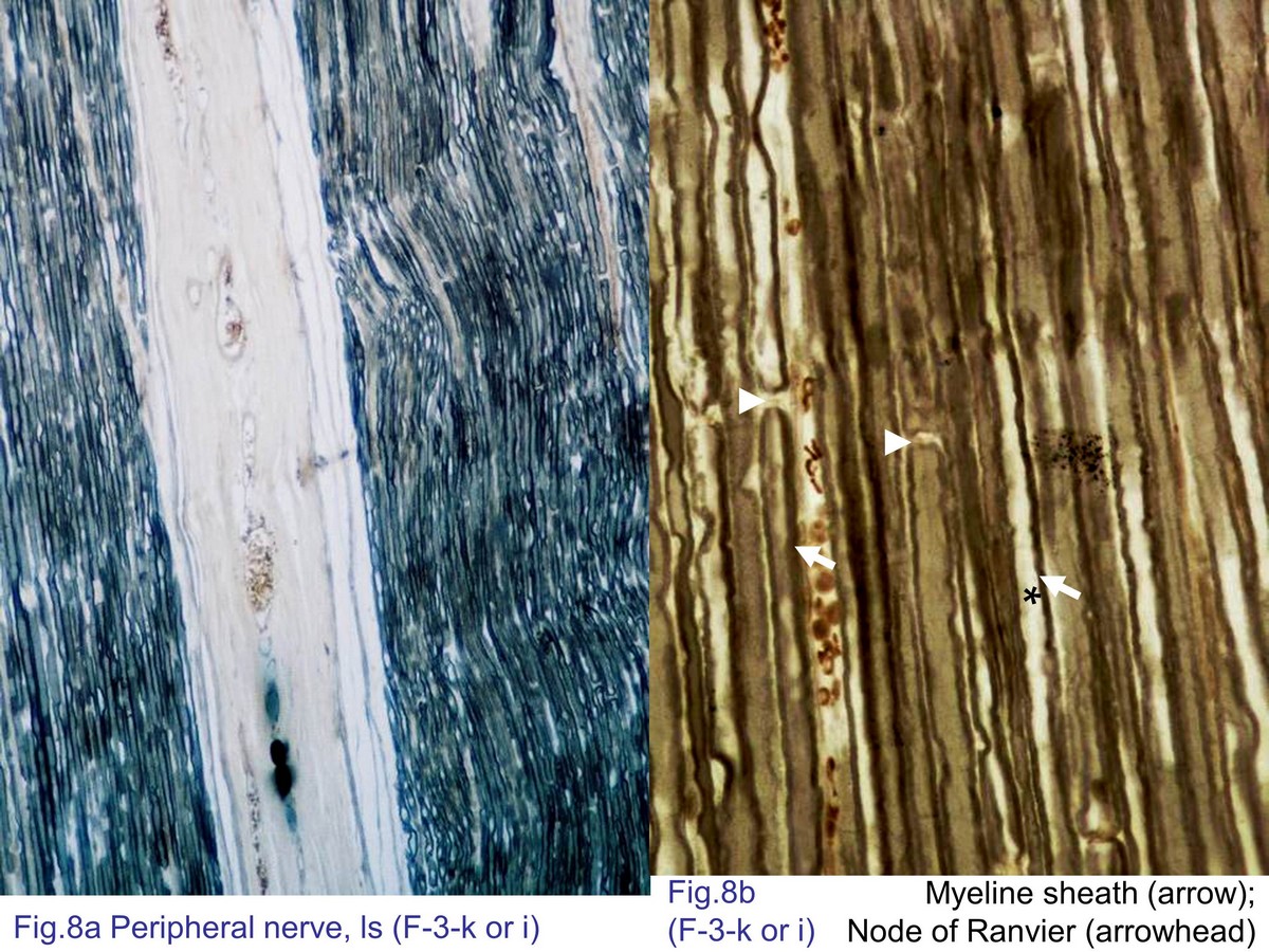 block7_20.jpg - Fig. 8 Longitudinal section of myelinated nerves. Axons(asterisk) are surrounded by the myelin sheath (arrow) andthe space lacks myelin sheath called the nodes of Ranvier(arrowhead).