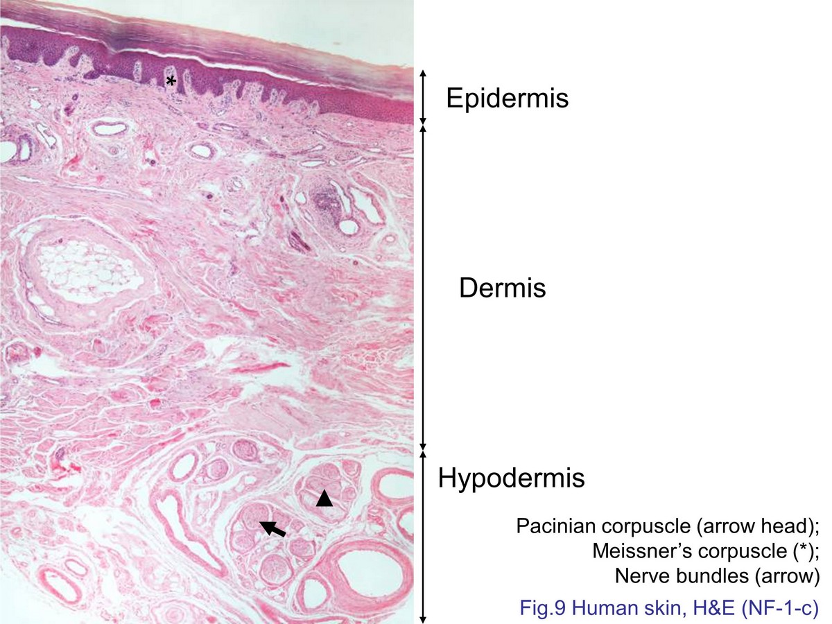 block7_22.jpg - Fig. 9 Tangential section of skin. Skin is composed ofepidermis and underlay dermis. Dermis have the finger-likeprotrusion into the epidermis, called dermal papillae andthe Meissner's corpuscle (asterisk) housed in the apical ofdermal papillae. Pacinian corpuscles (arrowhead) andnerve bundle (arrow) are found in the deep layer of dermis.