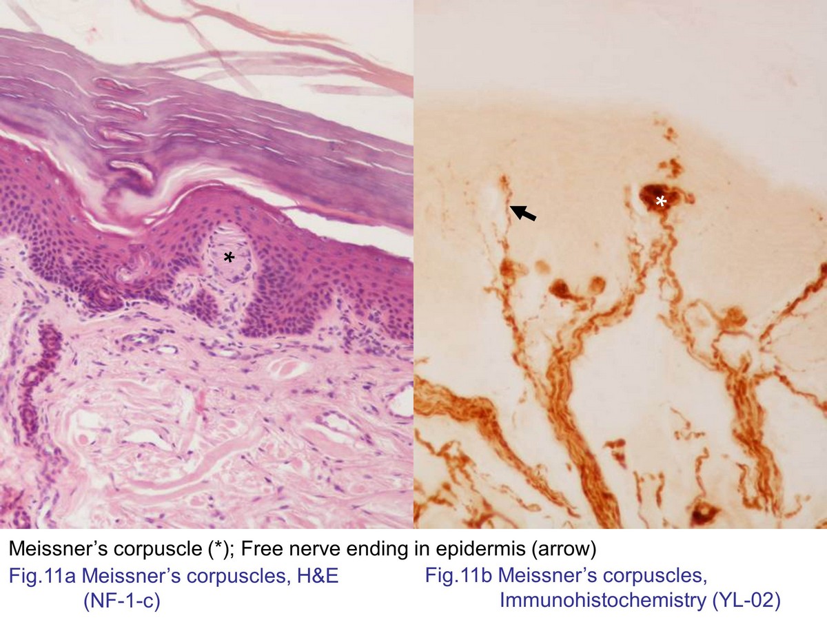 block7_26.jpg - Fig. 11 Photomicrograph of Meissner's corpuscles.Meissner's corpuscle housed in the apical of dermalpapillae and only lamellae cells of Meissner's corpusclecould be observed with the H&E staining (Fig. 11a).Meissner's corpuscle was innervated by nerve fibers thatdemonstrated with the pan-axonal (Fig. 11b).