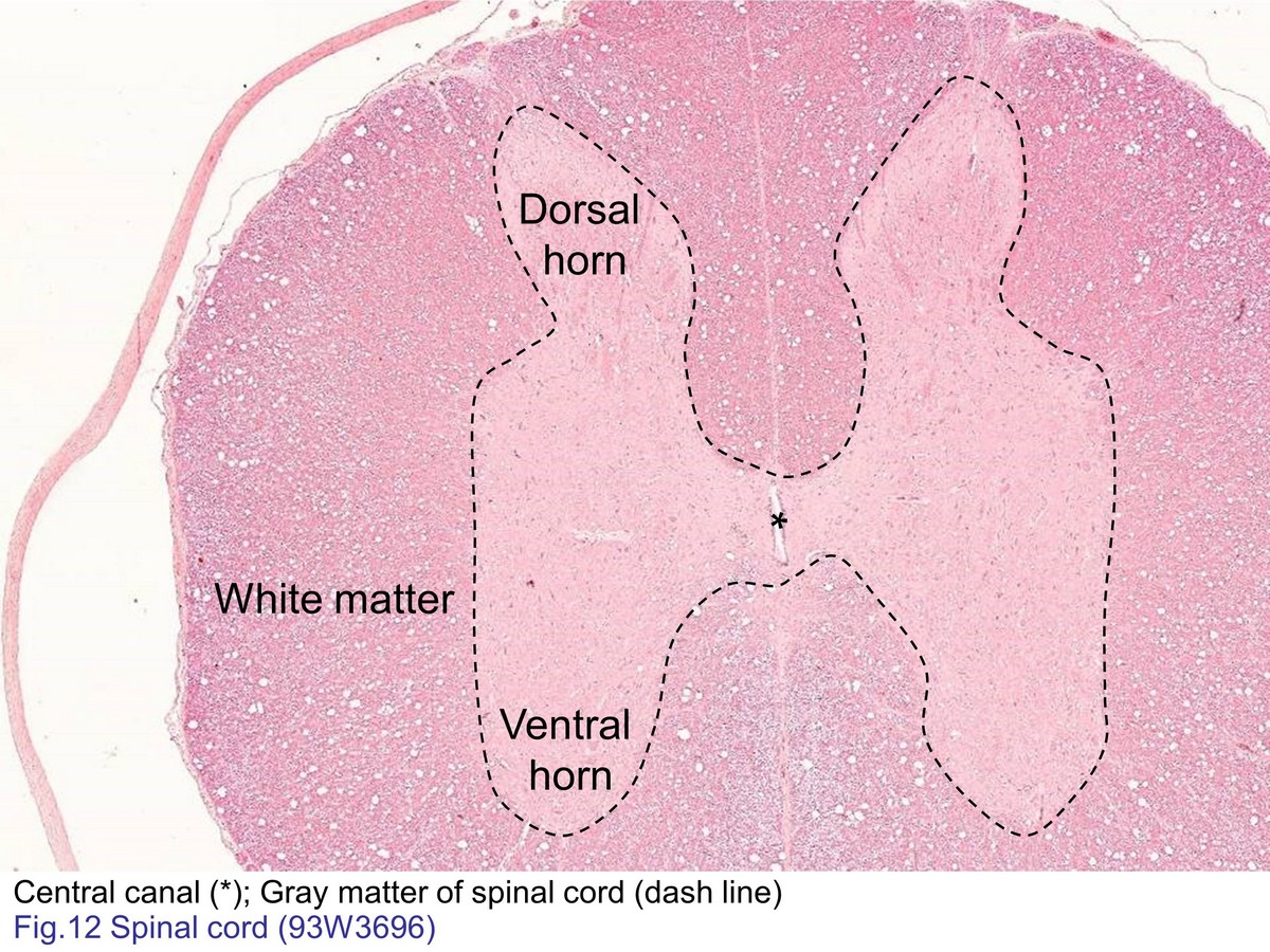block7_28.jpg - Fig. 12 Cross-sectioned of spinal cord. Spinal cord iscomposed of inner part of gray matter that neuronal cellbody-gathering and outer white matter that containednumerous ascending and descending tract. The graymatter of the spinal cord appears roughly in butterfly-shape,with dorsal horn that sensory input and ventral horn thatmotor fiber leave. The central canal lies in the centralcommissure of gray matter.