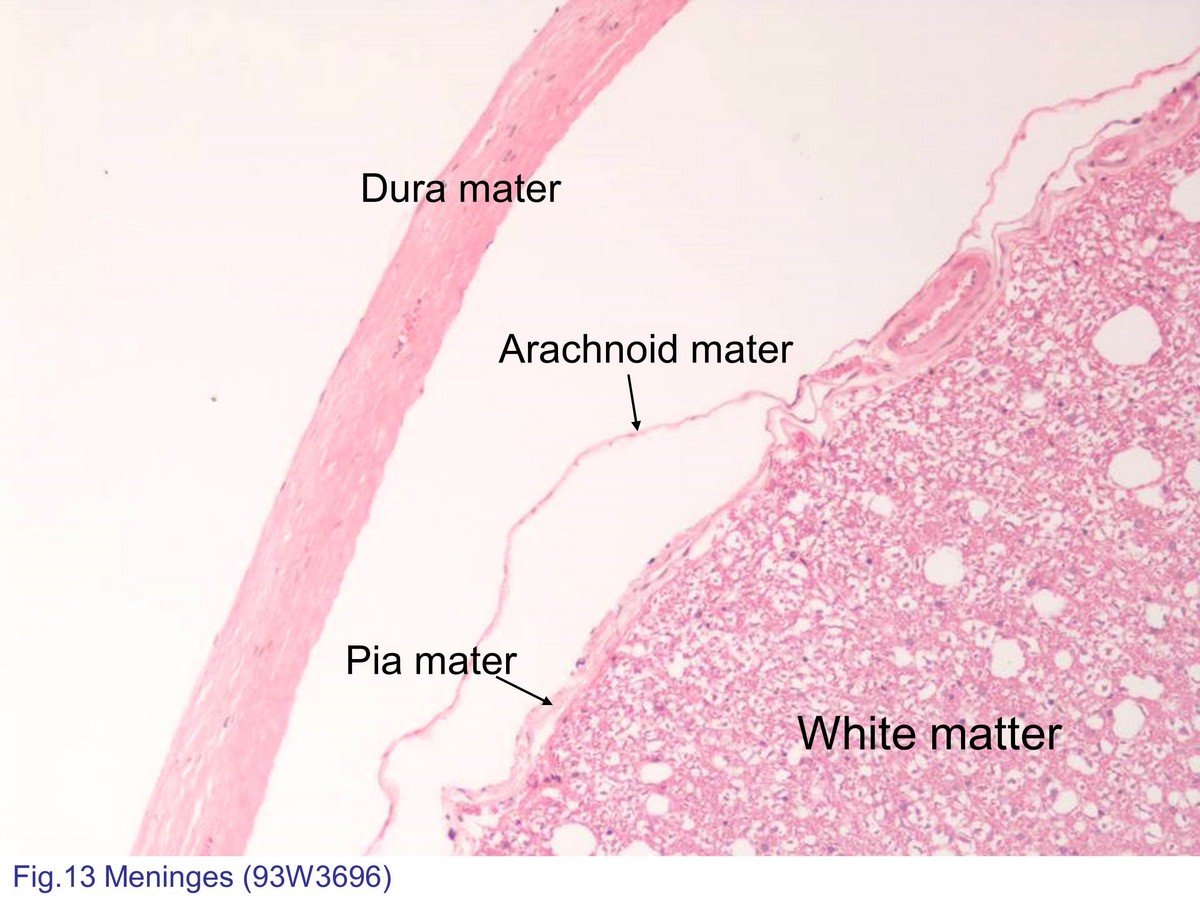 block7_30.jpg - Fig. 13 Meninges of central nervous system. The brain andspinal cord are covered by three layers of meninges. Thesurface of the nervous tissue is covered by a delicate layercalled the pia mater. Overlying the pia mater is a thickerfibrous layer, the arachnoid mater. The space between thepia and arachnoid layers is called the subarachnoid space.External to the arachnoid mater is a dense fibroelastic layercalled the dura mater. Note the white matter in the spinalcord is composed of myelinated axons.