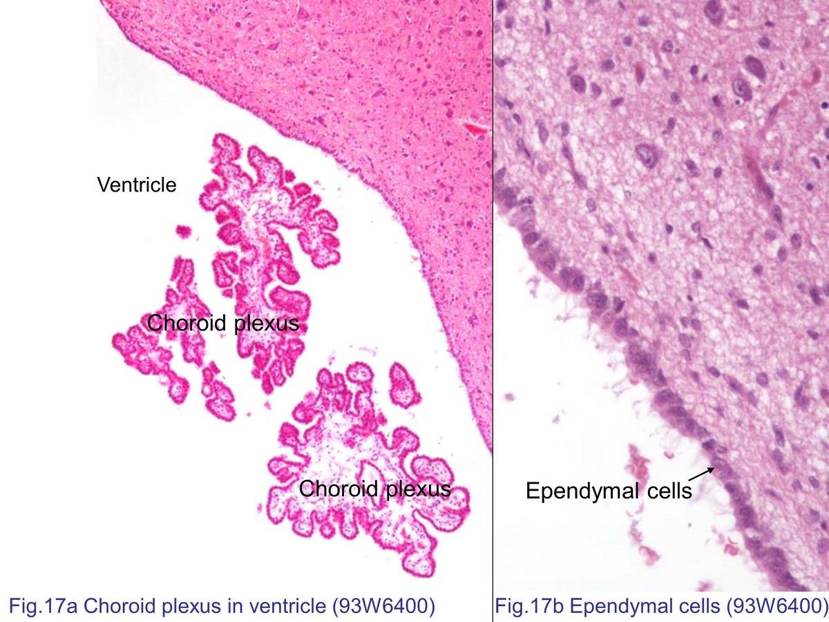 block7_38.jpg - Fig. 17a Low magnification of the choroid plexus. Thechoroid plexus is a vascular structure arising from the wallof ventricles of the brain and responsible for the productionof cerebrospinal fluid (CSF). Each choroid plexus iscomposed of cuboidal or columnar epithelium and adjacentcapillary.Fig. 17b High magnification of ependymal cells.Ependymal cells formed the lining of the ventricles andspinal canal. Ependymal cells lack base membrane andwith numerous cilia and microvilli that projected in the thelumen of ventricles.