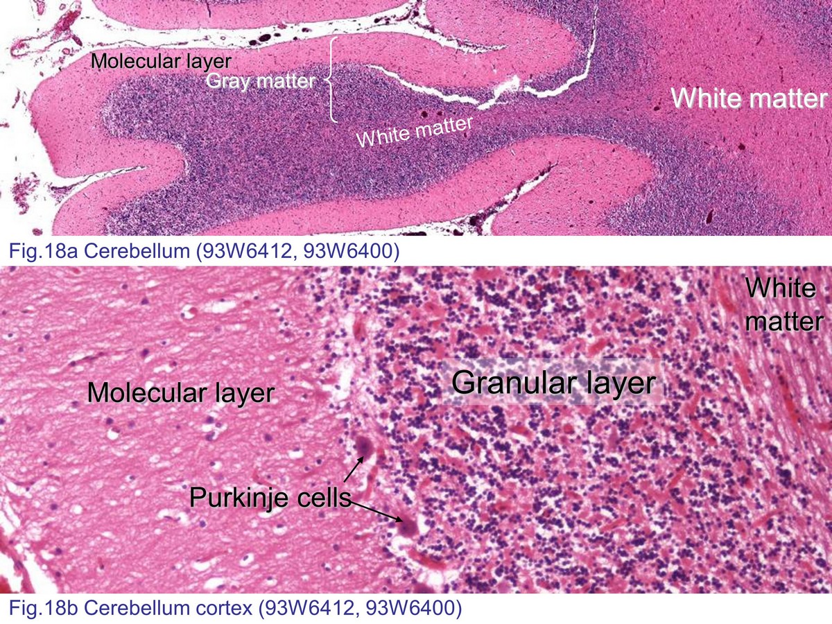 block7_40.jpg - Fig. 18 Photomicrograph of cerebellarhemispheres. A. Low magnification of cerebellarhemisphere. B. High magnification of cerebellarhemisphere. Cerebellar cortex is composed ofouter of molecular layer, middle of purkinje celllayer and underlies of granular layer. Deep to thecerebellar cortex is the white matter.