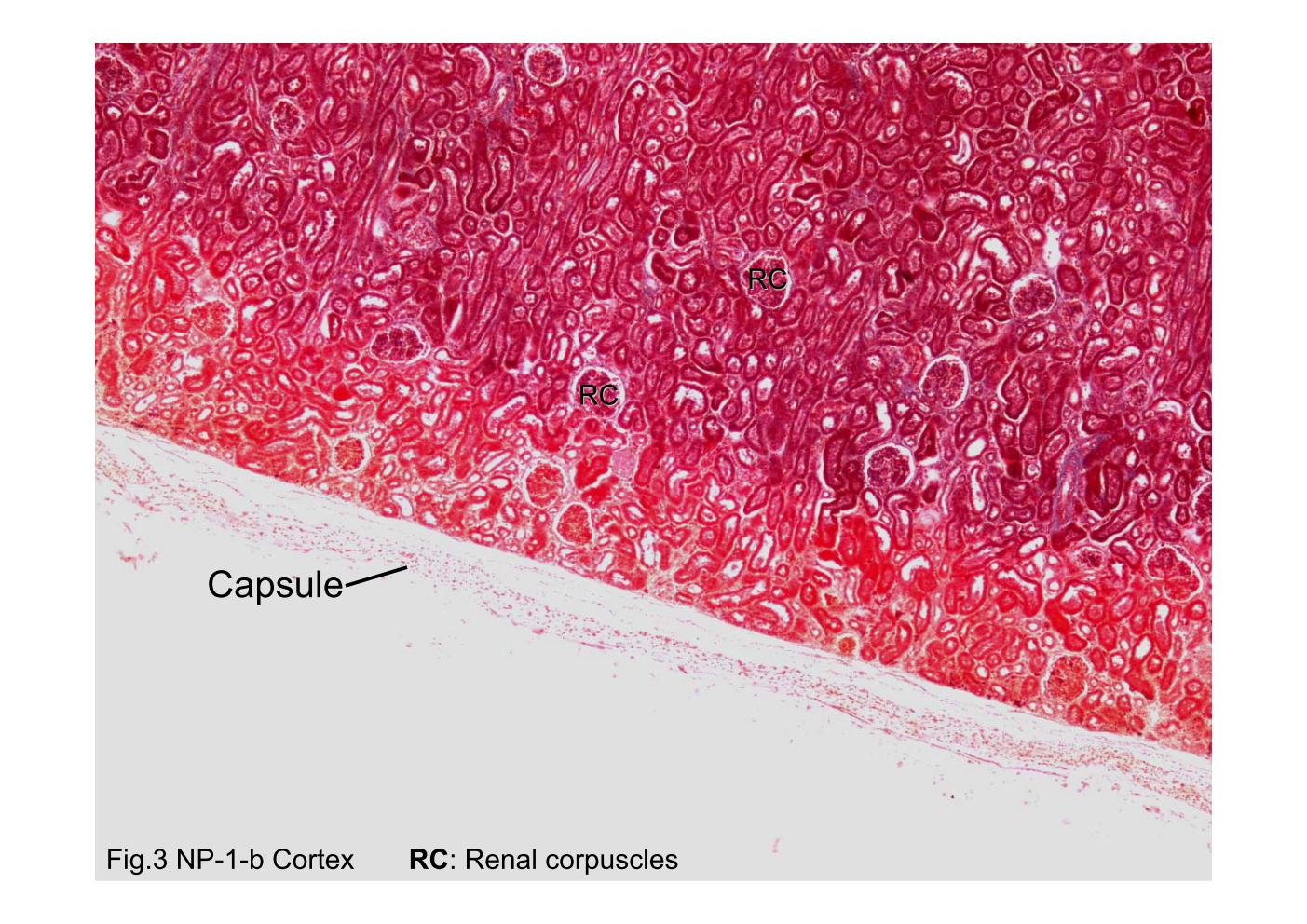 block8_06.jpg - Fig.3 Photomicrograph of kidney capsule. This photo-micrograph shows the capsule and part of the underlyingcortex. The capsule is composed of dense connective tissue,but its color faded away. The most distinctive feature of therenal cortex is the presence of the renal corpuscles (RC).