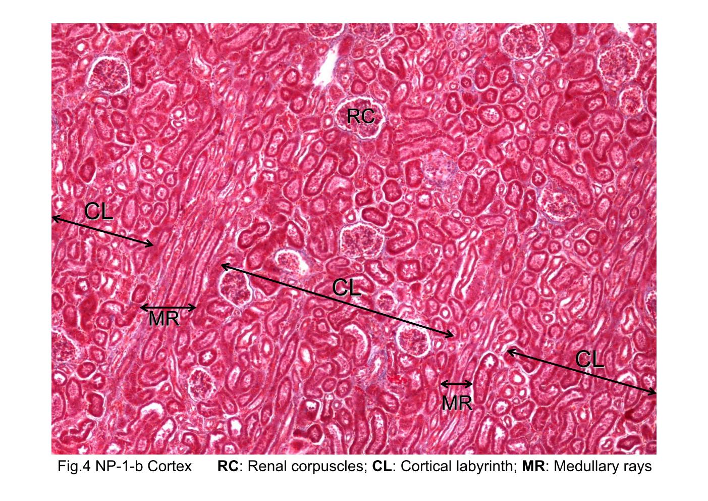 block8_08.jpg - Fig 4. The microscopic structure of renal cortex. The renalcortex can be divided into regions referred to the corticallabyrinth (CL) and the medullary rays (MR). The corticallabyrinth contains the renal corpuscles (RC). Surrounding eachrenal corpuscle are the proximal and distal convoluted tubules,which are also part of the cortical labyrinth. The medullary raysare composed of groups of straight tubules oriented in thesame direction and appear to radiate from the medulla. Whenthe medullary rays are cut longitudinally, as they are in thisfigure, the tubules present elongated profiles. The medullaryrays contain proximal thick segments (descending limb ofHenle's loop), distal thick segments (ascending limbs of Henle'sloop), and collecting tubules. But they can¡¦t be identified well inthis slide.