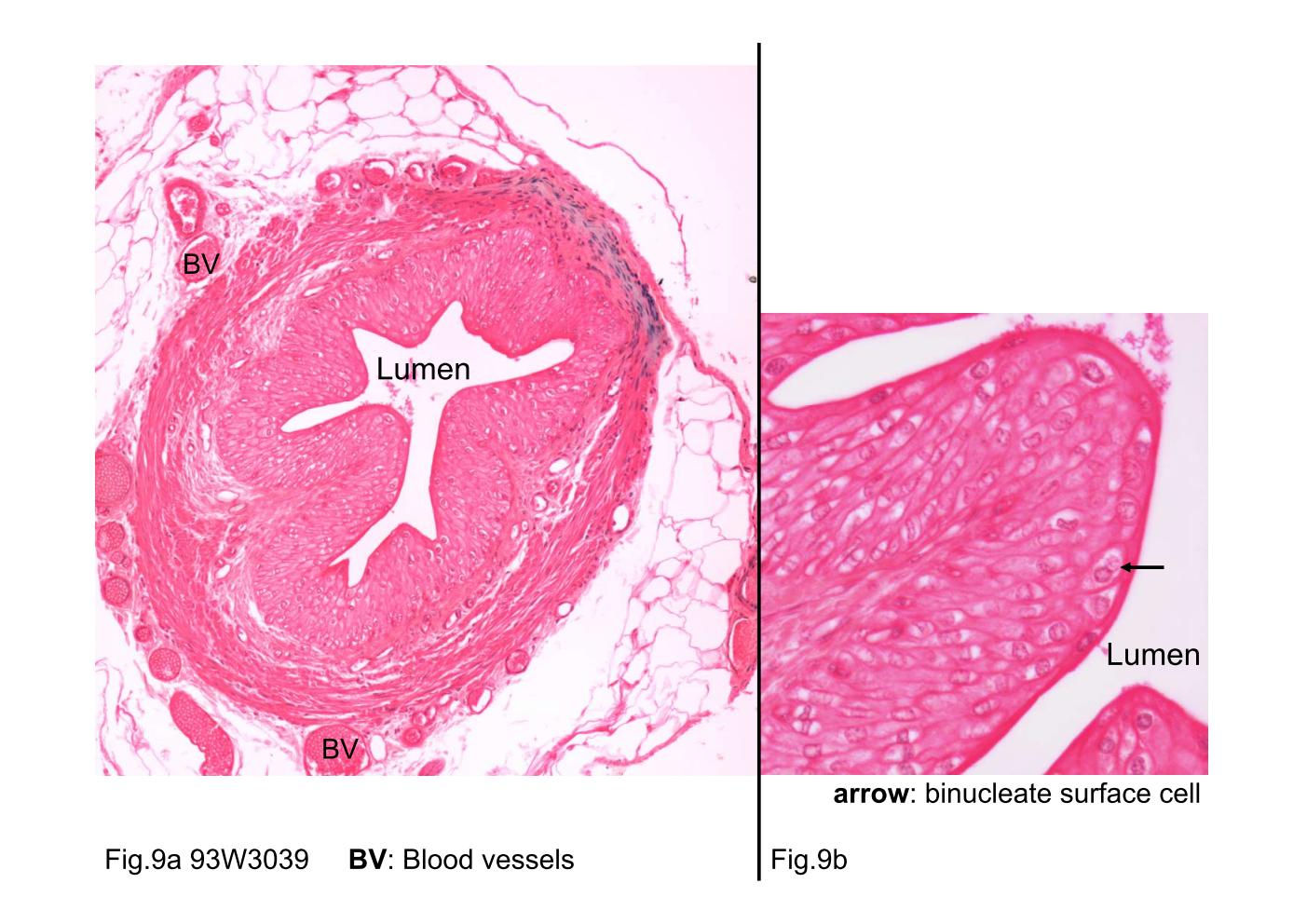 block8_17.jpg - Fig.9 93W3039, Transitional epithelium (cs) , HE. ThisH&E-stained specimen shows the 5- to 6-cell-layer thicknessof the epithelium in the relaxed ureter. The surface cells arecharacteristically the largest, and some surface cells arebinucleate (arrow). The ability of this epithelium to becomethinner and flatter allows all of these passages toaccommodate to distension by the urine.