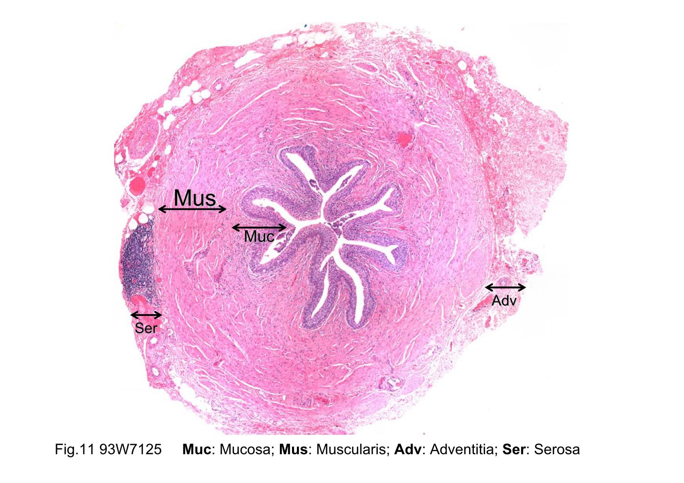 block8_19.jpg - Fig.11 93W7125, Ureter (cs) , HE. As shown in this low-power orientation micrograph, the wall of the ureter consistsof a mucosa (Muc), a muscularis (Mus), and an adventitia(Adv). Note that the ureters are located behind theperitoneum of the abdominal cavity in their course to thebladder. Thus, a serosa (Ser) may be found covering aportion of the circumference of the tube. Also, because ofcontraction of the smooth muscle of the muscularis, theluminal surface is characteristically folded, thus creating astar-shaped lumen.