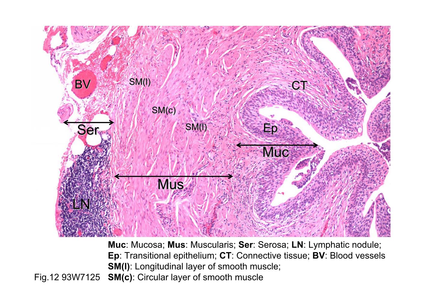 block8_21.jpg - Fig.12 93W7125, Ureter (cs) , HE. The thick epitheliai liningis the transitional epithelium (Ep). The remainder of the wall ismade up of connective tissue (CT) and smooth muscle. Thetransitional epithelium and its supporting connective tissueconstitute the mucosa (Muc). A distinct submucosa is notpresent. The muscularis (Mus) is arranged as an innerlongitudinal layer (SM(l)), a middle circular layer (SM(c)), andan outer longitudinal layer (SM(l)). However, the outerlongitudinal layer is present only at the lower end of the ureter.By the way, there are blood vessels (BV) and lymphaticnodule (LN) in the serosa (Ser).