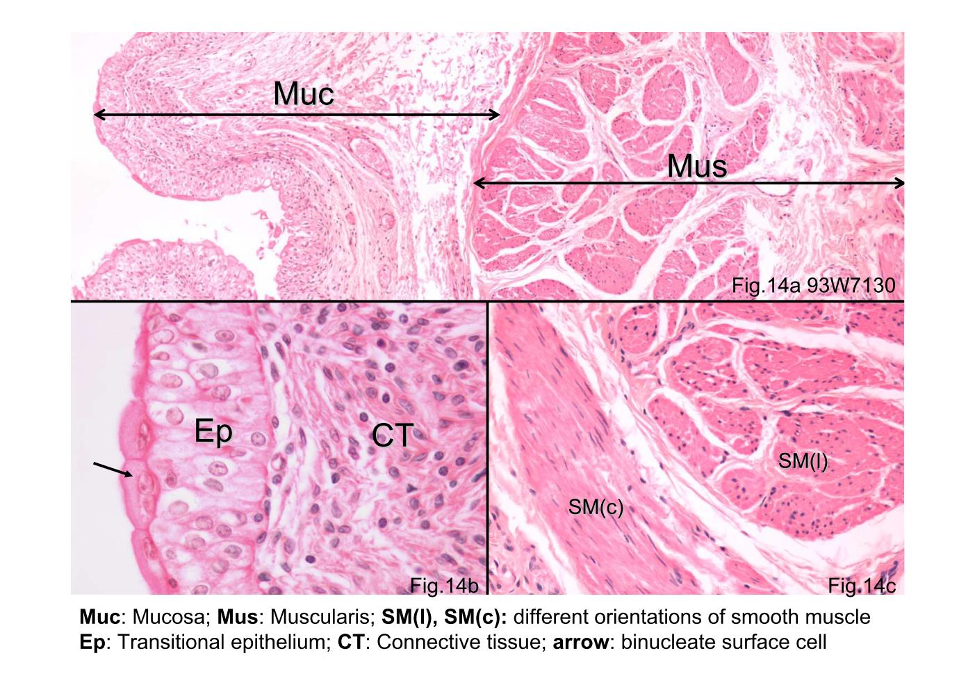 block8_25.jpg - Fig.14 93W7130, Urinary bladder human (cs), HE. Thetransitional epithelium (Ep) lining the bladder is seen on theleft. Beneath the epithelium is a relatively thick layer ofconnective tissue (CT) containing blood vessels of varioussizes. The epithelium and connective tissue constitute themucosa (Muc) of the bladder. The transitional epithelium isoften characterized by the presence of surface cells thatexhibit a "dome" shape. In addition, many of these surfacecells are binucleate (arrows). The muscularis (Mus) consistsof smooth muscle arranged as an inner longitudinal layer, amiddle circular layer, and an outer longitudinal layer, but it isless regularly arranged than the description indicates.