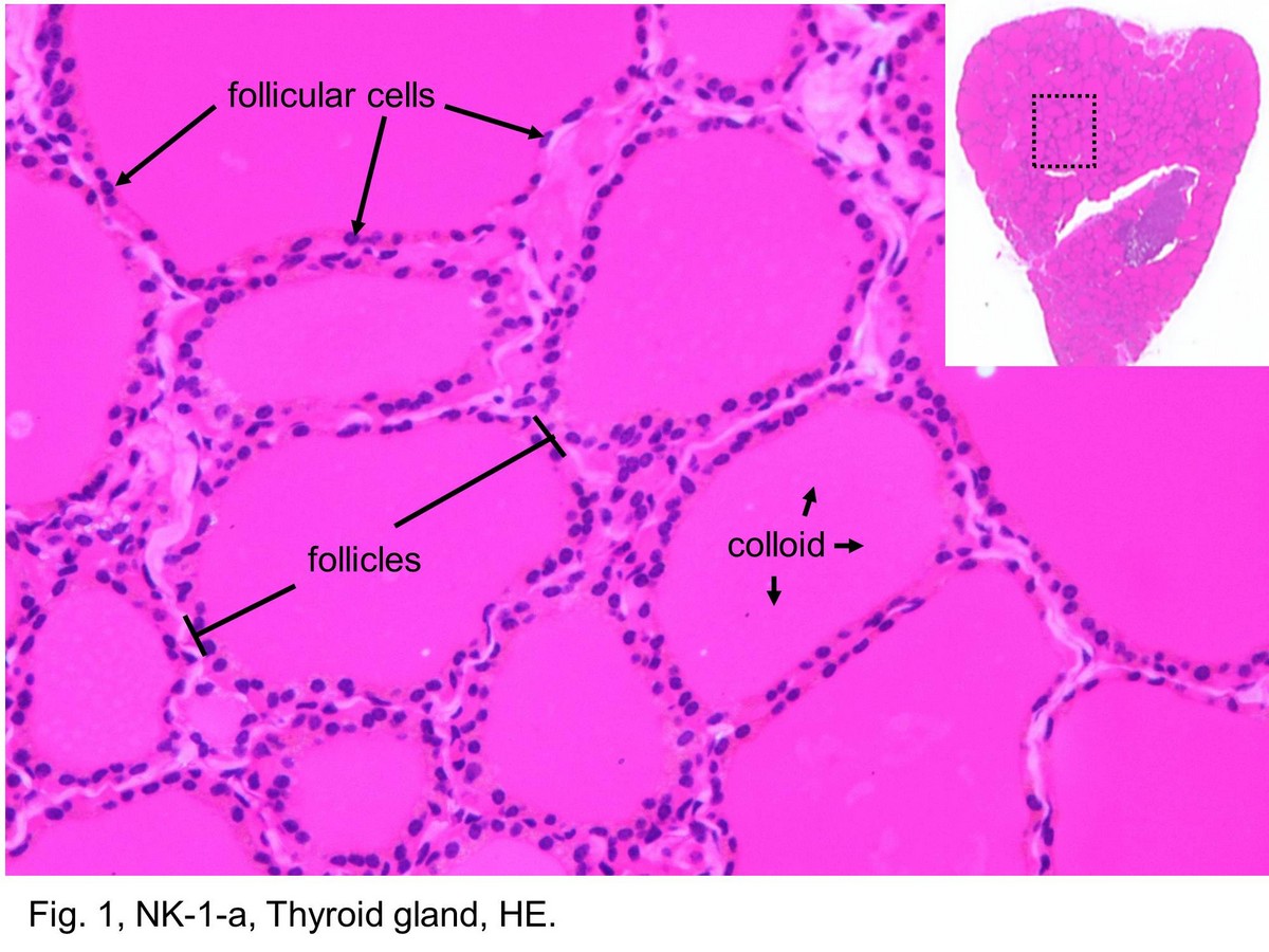 block11_05.jpg - Fig. 1, NK-1-a, Thyroid gland, HE.A histologic section of the thyroid gland is shown here. The  follicles vary somewhat in size and shape and appear  closely packed. The homogeneous mass in the center of  each follicle is the colloid. The follicular cells appear to form  a ring around the colloid and the nuclei of the cells serve as  an indication of their location and arrangement. Para-  follicular cells could be found in thyroid gland, however  these cells are very sparse.