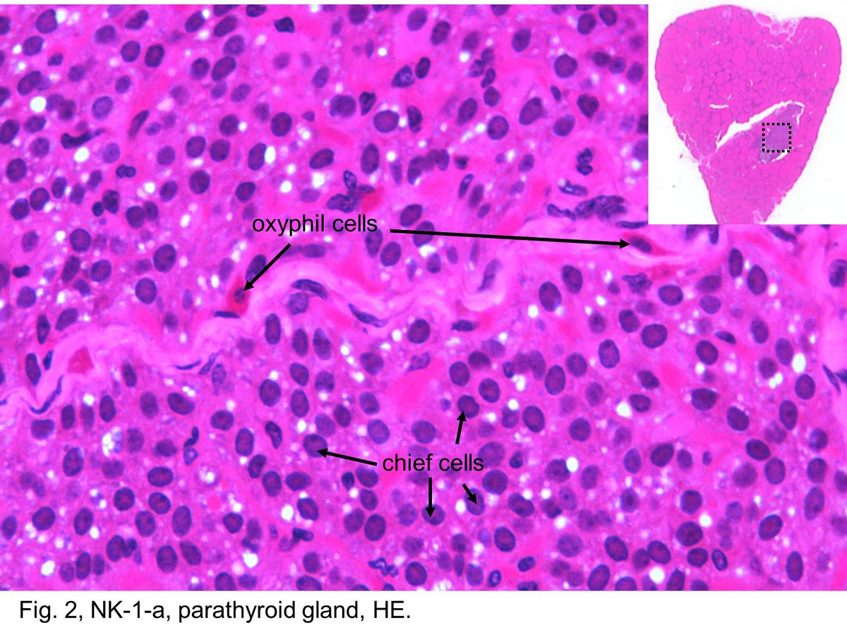 block11_07.jpg - Fig. 2, NK-1-a, parathyroid gland, HE.Two parenchymal cell types can be distinguished in routine  H&E sections: chief cells (principal cells) and oxyphil cells.  The chief cells are more numerous. They contain a spherical  nucleus surrounded by a small amount of cytoplasm.  Oxyphil cells are less numerous. They are conspicuously  larger than chief cells but have a slightly smaller and more  intensely staining nucleus. Their cytoplasm stains with eosin,  and the boundaries between the cells are usually well  marked.