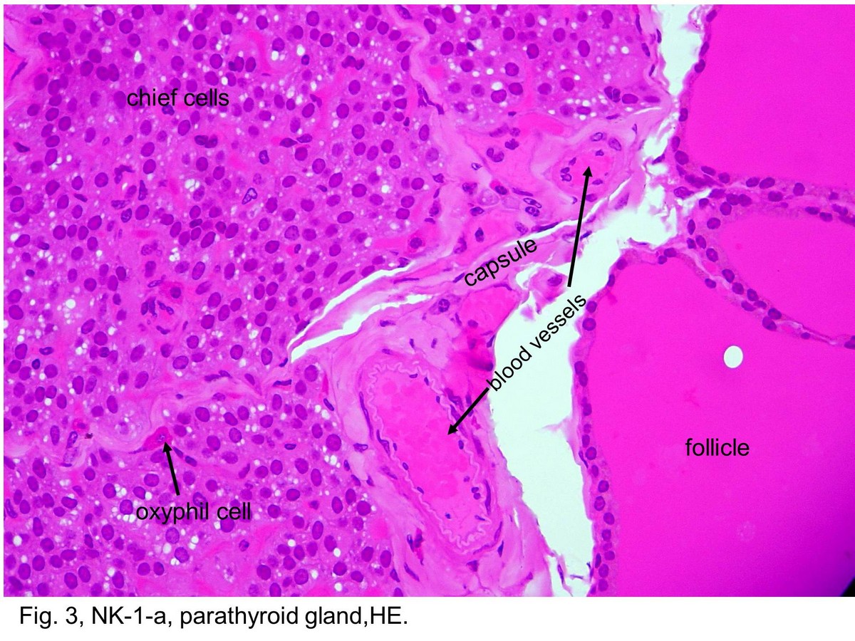 block11_09.jpg - Fig. 3 NK-1-a, parathyroid gland,HE.As seen here, the blood vessels are associated with the  capsule of the parathyroid gland. The parenchyma of the  parathyroid glands appears as cords or sheets of cells  separated by capillaries and delicate connective tissue  septa.