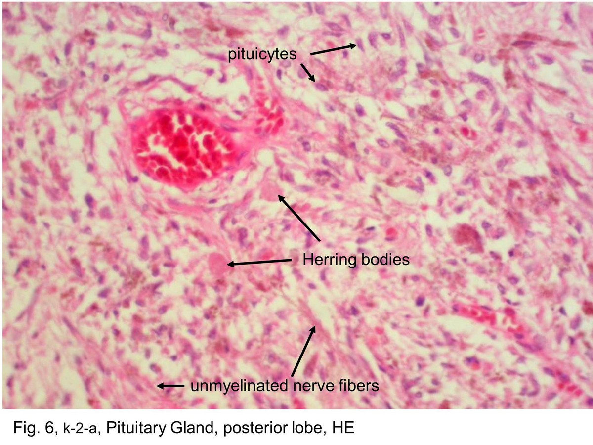 block11_14.jpg - Fig. 6 & 7, NK-2-c, k-2-a, Pituitary Gland, anterior lobe, HEThis photomicrograph shows a region of the anterior lobe. The  acidophils are readily identified by the acidophilic staining of  their cytoplasm, in contrast to the basophils whose  cytoplasm is clearly basophilic. Chromophobes are also  very numerous in this field. The cytoplasm stains poorly in  contrast to that of the acidophils and basophils. The cells  are arranged in cords and clumps, between which are  capillaries. Some of the capillaries can be recognized, but  most are in a collapsed state and difficult to visualize at this  magnification.