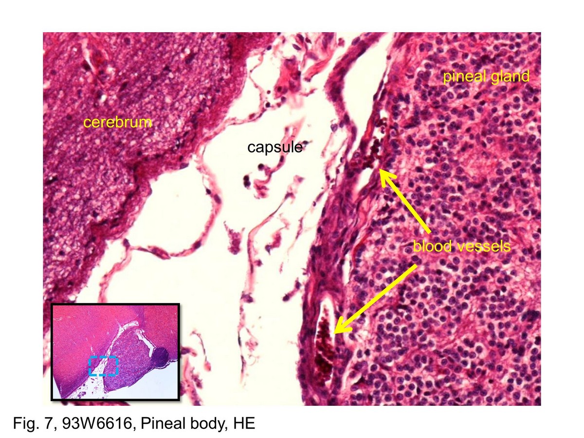 block11_15.jpg - Fig. 6 & 7, NK-2-c, k-2-a, Pituitary Gland, anterior lobe, HEThis photomicrograph shows a region of the anterior lobe. The  acidophils are readily identified by the acidophilic staining of  their cytoplasm, in contrast to the basophils whose  cytoplasm is clearly basophilic. Chromophobes are also  very numerous in this field. The cytoplasm stains poorly in  contrast to that of the acidophils and basophils. The cells  are arranged in cords and clumps, between which are  capillaries. Some of the capillaries can be recognized, but  most are in a collapsed state and difficult to visualize at this  magnification.