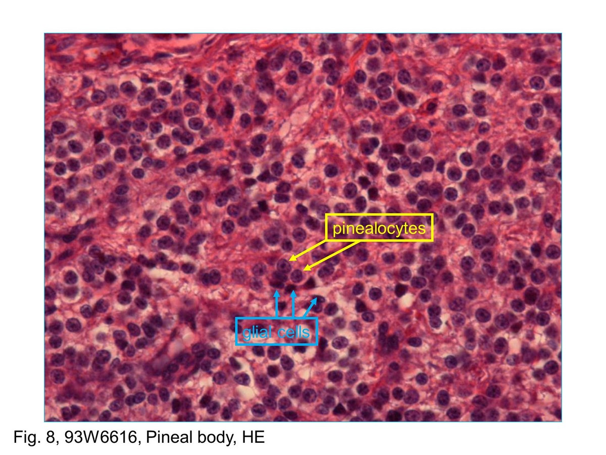 block11_17.jpg - Fig. 8 & 9, NK-2-c, k-2-a Pituitary Gland, posterior lobe, HEThe posterior lobe seen here contains the nuclei inside the cells  called pituicytes, and unmyelinated nerve fibers extended  from the nuclei of the hypothalamus. The pituicytes are  comparable with neuroglial cells of the central nervous system.  The nuclei are round to oval. In H&E preparations such as this,  the cytoplasm of the pituicyte cannot be distinguished from the  unmyelinated nerve fibers. The hormones of the posterior lobe  are formed in the hypothalamic soma and pass via the nerve  fibers to the posterior lobe, where they are stored in the  expanded nerve terminal portion of the nerve fibers. The  stored neurosecretory material appears as Herring bodies. In  H&E preparations, the Herring bodies simply appear as small  islands of eosin-stained substance.