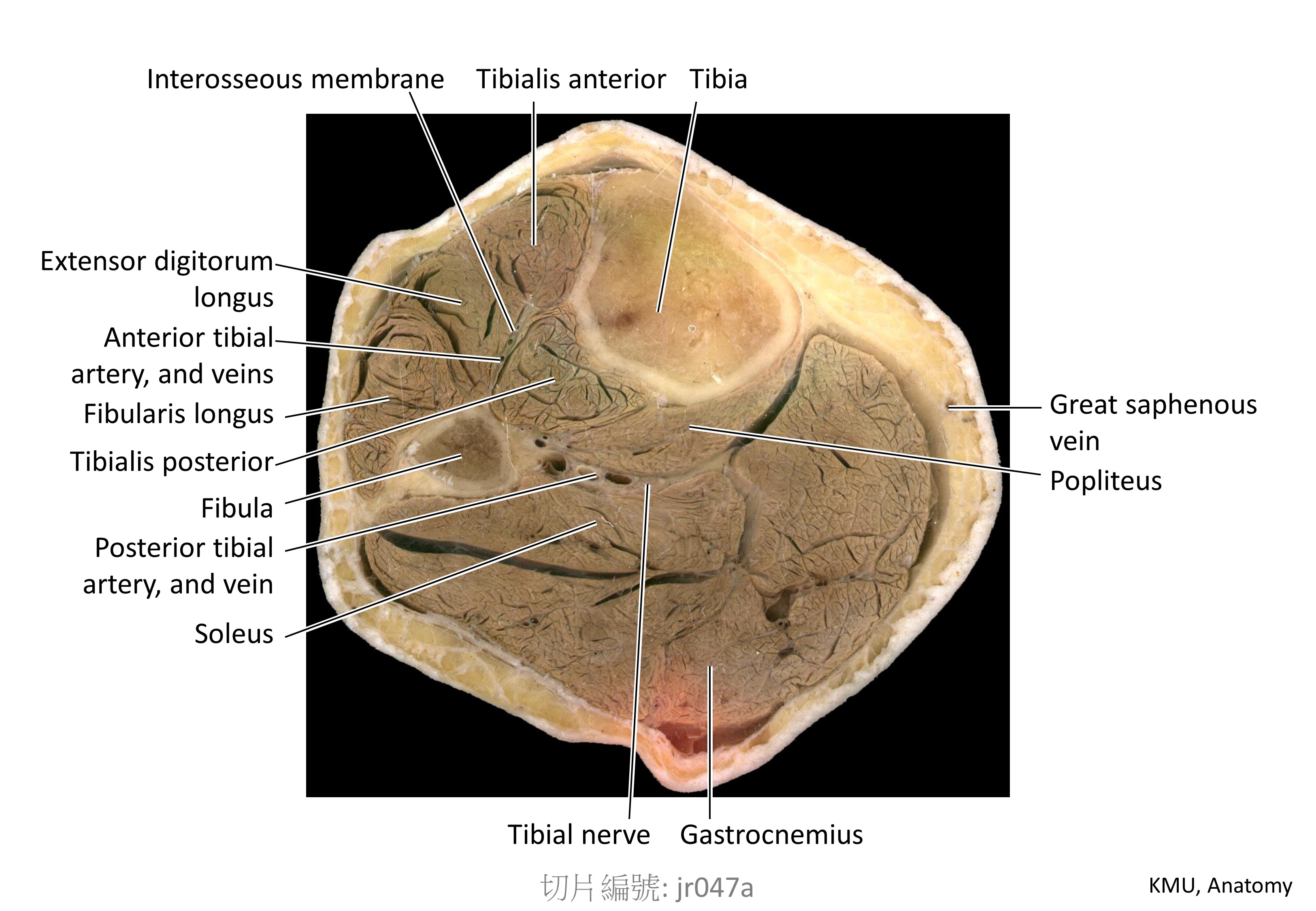 KMU Anatomy Sections